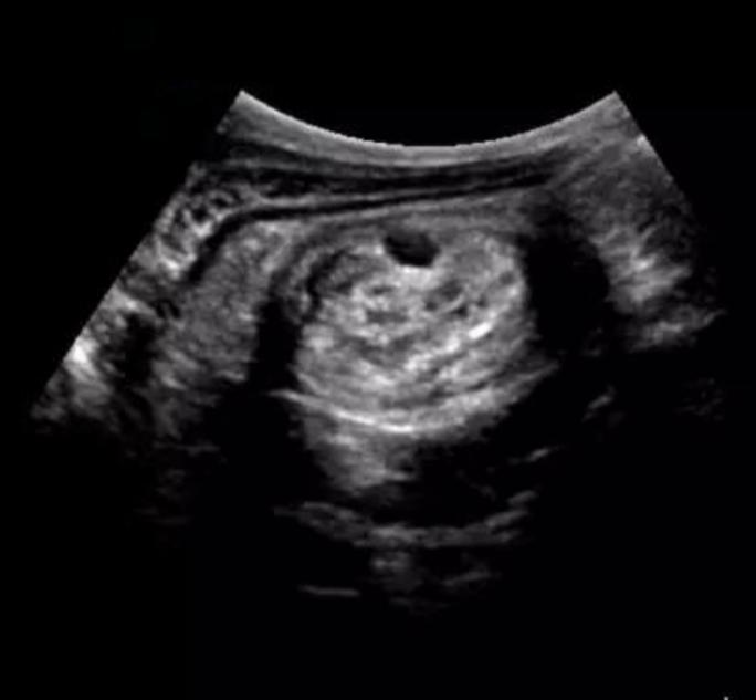 狗狗细小病毒恢复期拉血,狗狗得了细小病毒有抽搐症状