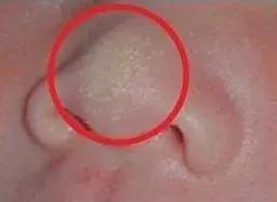 新生儿皮肤问题怎么解决,家有新生儿怎么办