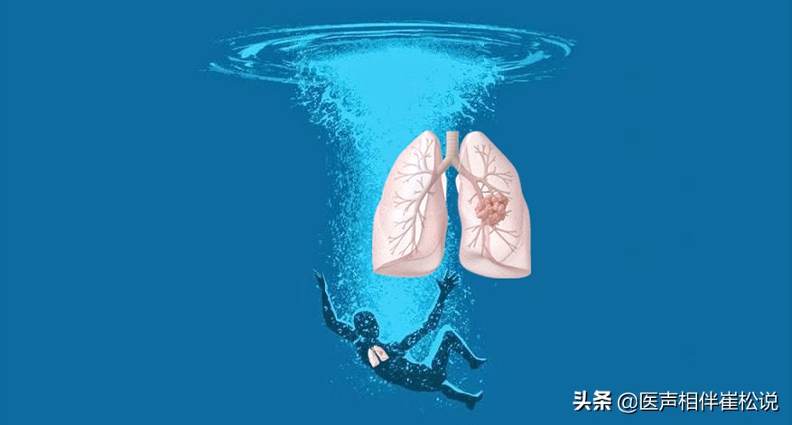 脚肿？腿肿？脸肿？眼泡肿？这些水肿要注意了