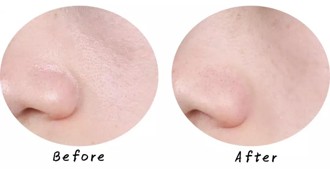 最好用清洁面膜排行榜前十名图片,公认最好用的清洁面膜混油皮