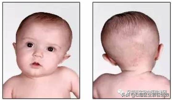 宝宝老是歪头后仰头,宝宝歪脖歪头怎么办