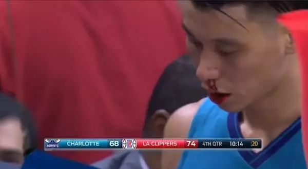 林书豪新冠治愈了吗,林书豪新冠病毒