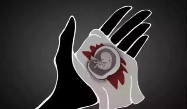 堕胎到底有没有恶果,堕胎真的那么可怕吗