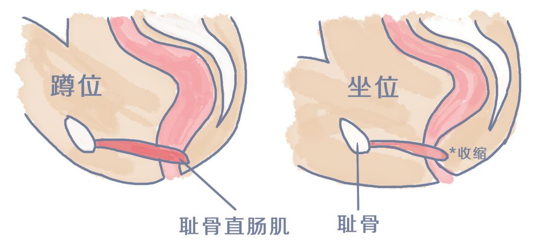 拉不出来？可能是姿势没选对
