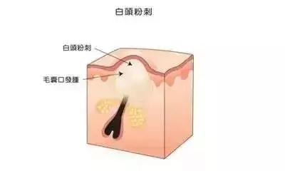 第一次入大牌护肤品应该怎样选择,第一次去日本怎么买化妆品