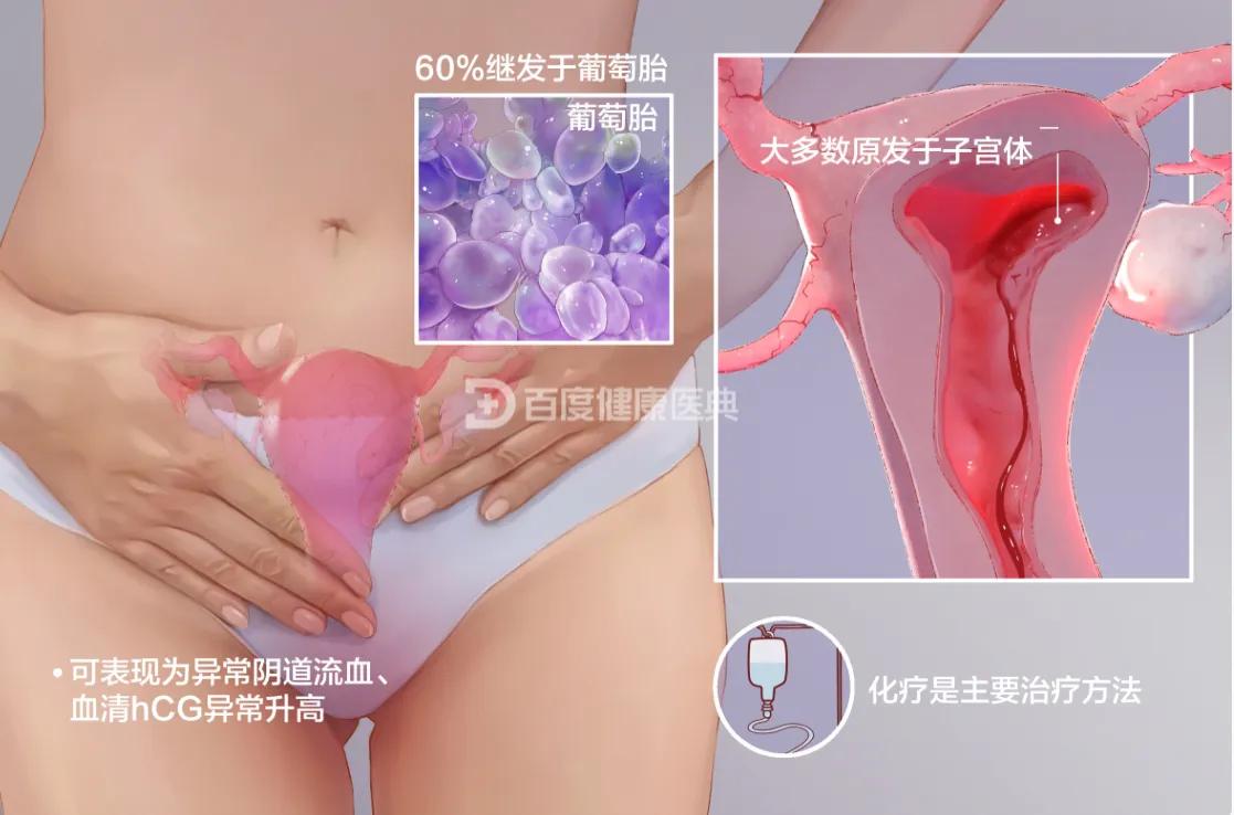 我的抗癌史,我的抗癌历程纪实