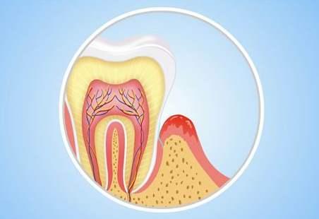 牙龈下移可以恢复么,年纪大牙龈松动怎么办