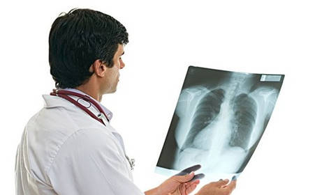 肺癌早、中、晚期如何区分？一文带来详细讲解