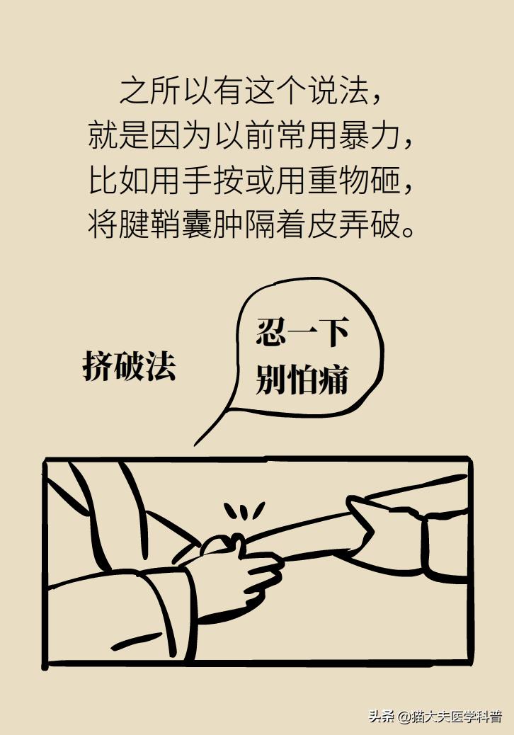 手腕长腱鞘囊肿,手腕上有个凸起的包腱鞘囊肿