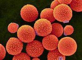 隐球菌抗原阴性肺癌,肺部微小结节会得肺癌吗