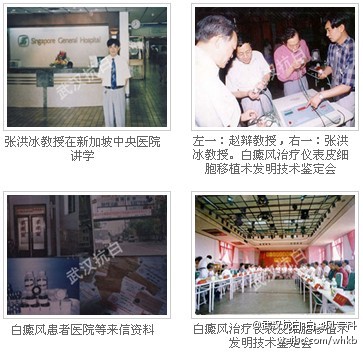 有几种方法可以治白癜风,这才是白癜风的最佳治疗方法