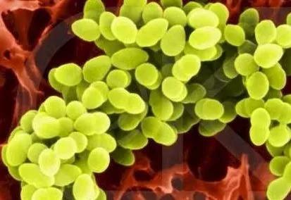 食物中毒吃益生菌管用吗,食物中毒腹泻可以喝益生菌吗