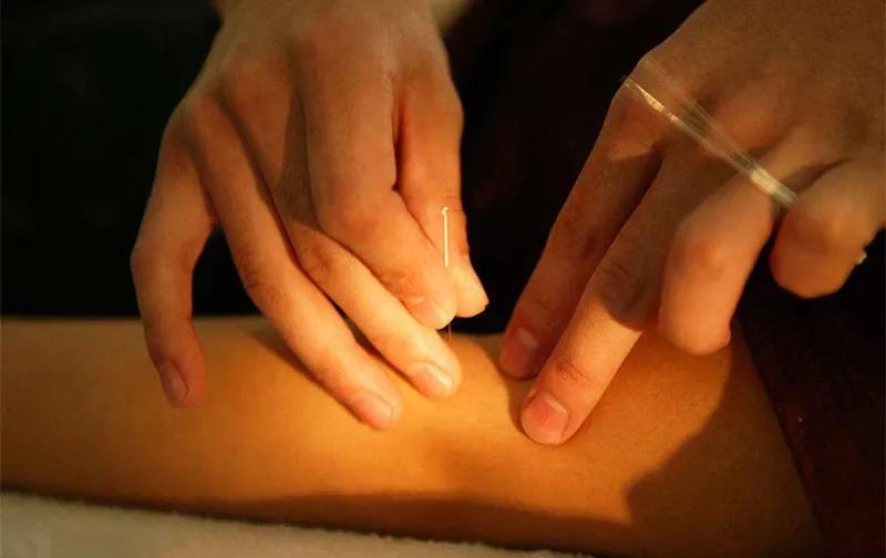 阴阳九针全息针法详解,灵枢针法视频教程