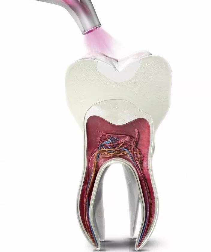 口碑好的补牙齿到底怎么样,补牙材料不对劲