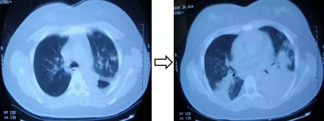 感染性疾病检测有问题,呼吸道感染诊疗指南