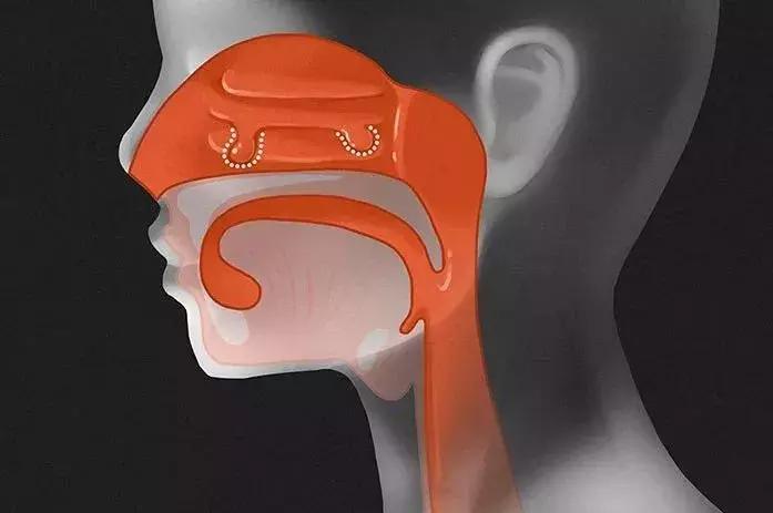 治疗咽喉肿痛有什么特效药,咽喉肿痛吃什么药