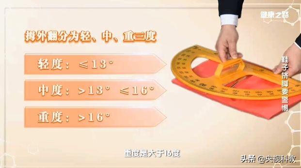 让你又丑又疼的拇外翻矫正方法在这里！还有测试哦