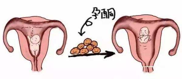 孕酮是什么?孕酮的全面知识详解