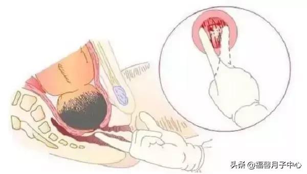 顺产开十指宝宝经过产道了么,顺产开十指了还能正常走路吗