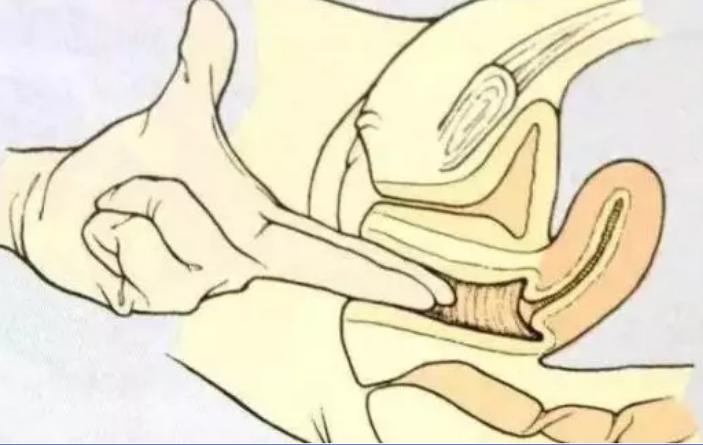 生孩子前的检查内检,内检是检查什么呢