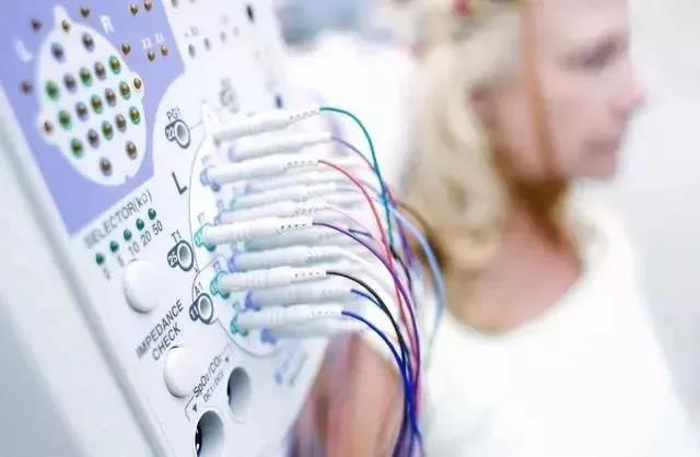 良性局限性癫痫脑电图特征,非惊厥性癫痫持续状态脑电图特征