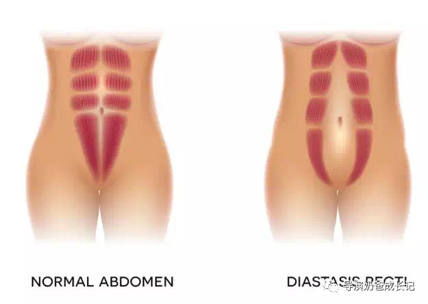单身的仙女们啊！这些当妈之后的身体真相，我想现在就让你们知道