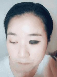 肿眼泡是什么原因啊,肿眼泡怎么贴双眼皮