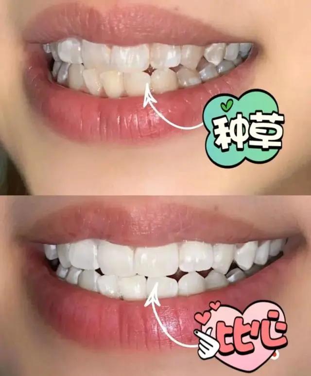 一张嘴臭牙齿就臭怎么办,一张嘴就口臭小妙招