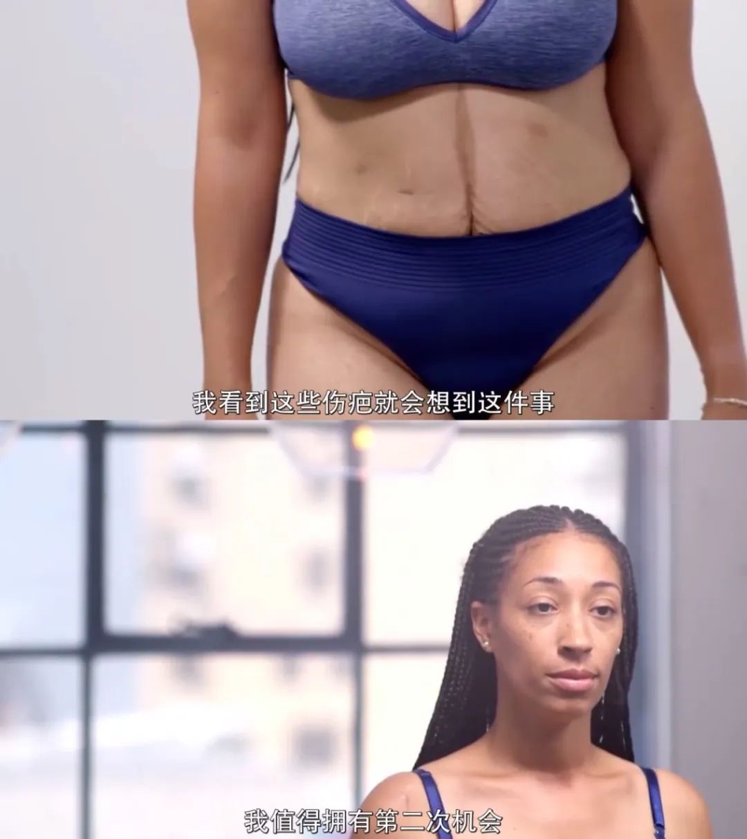 整容能弄成明星的样子吗,整容真的能整漂亮吗