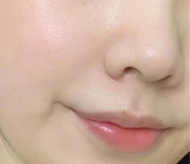 关于黑头的问题和解决方法,去黑头的误区许多人都中招了