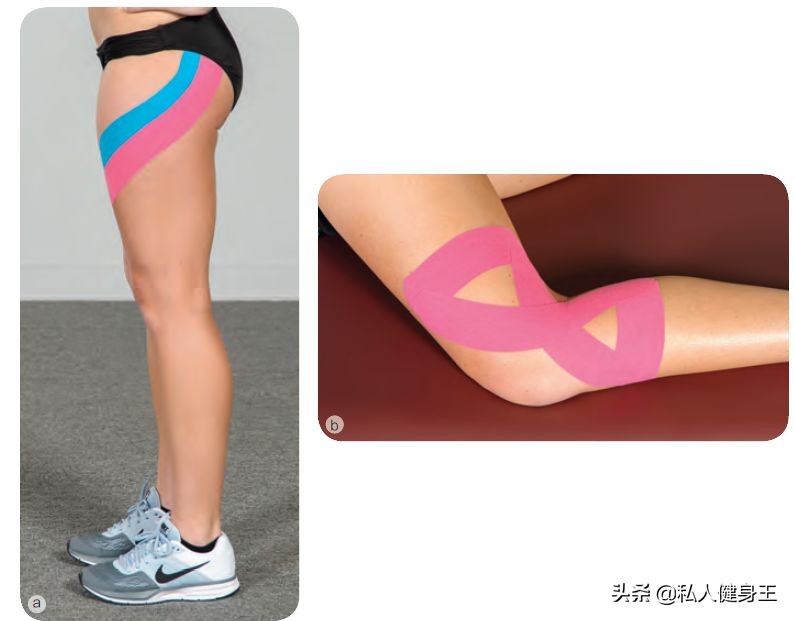 o型腿的原因与防治,o型腿的成因和危害