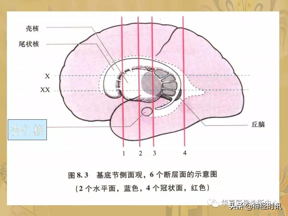 基底节ct解剖示意图,影像解剖图谱怎么用
