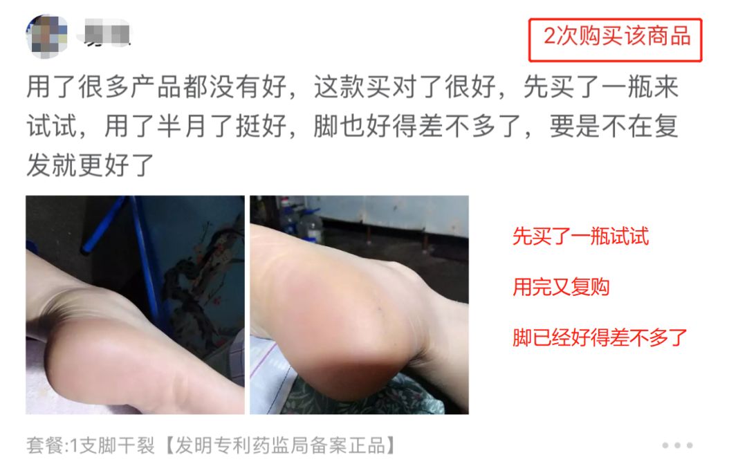 冬天脚跟干裂又起皮怎么办,冬天脚跟干裂起硬皮擦什么保湿好