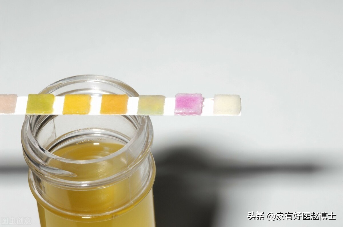 女性尿路感染尿痛还出血,女性尿路感染但是不尿痛