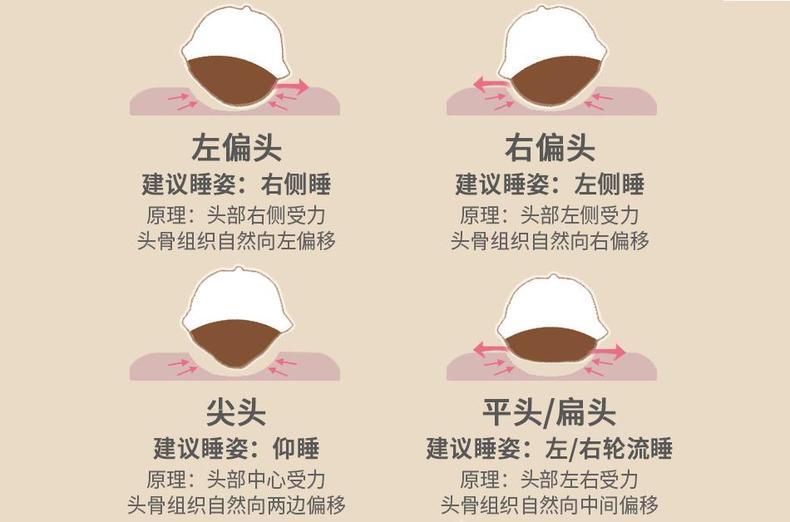 宝宝怎么睡才不会偏头,宝宝头睡偏了怎么纠正小妙招