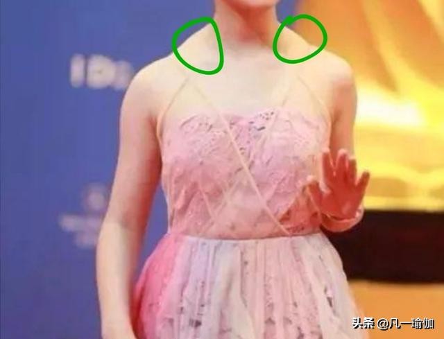 一个溜肩一个直角肩怎么改善,一边是直角肩一边是溜肩怎么改善