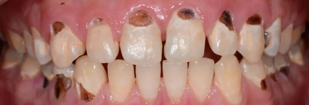 口腔牙医感言,牙医从业感悟