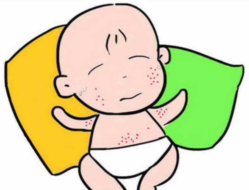长痱子怎么办婴幼儿,长痱子怎么办
