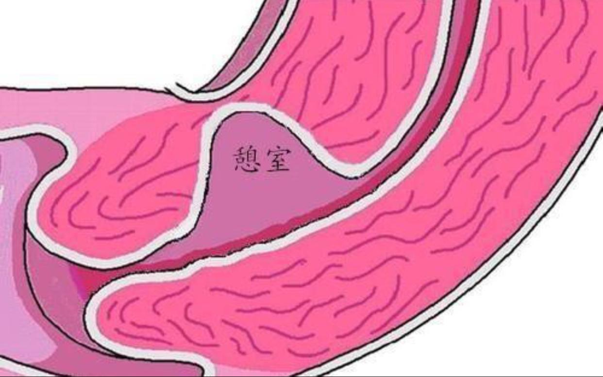 女生不孕不育自测图表,女生不孕不育自测图解