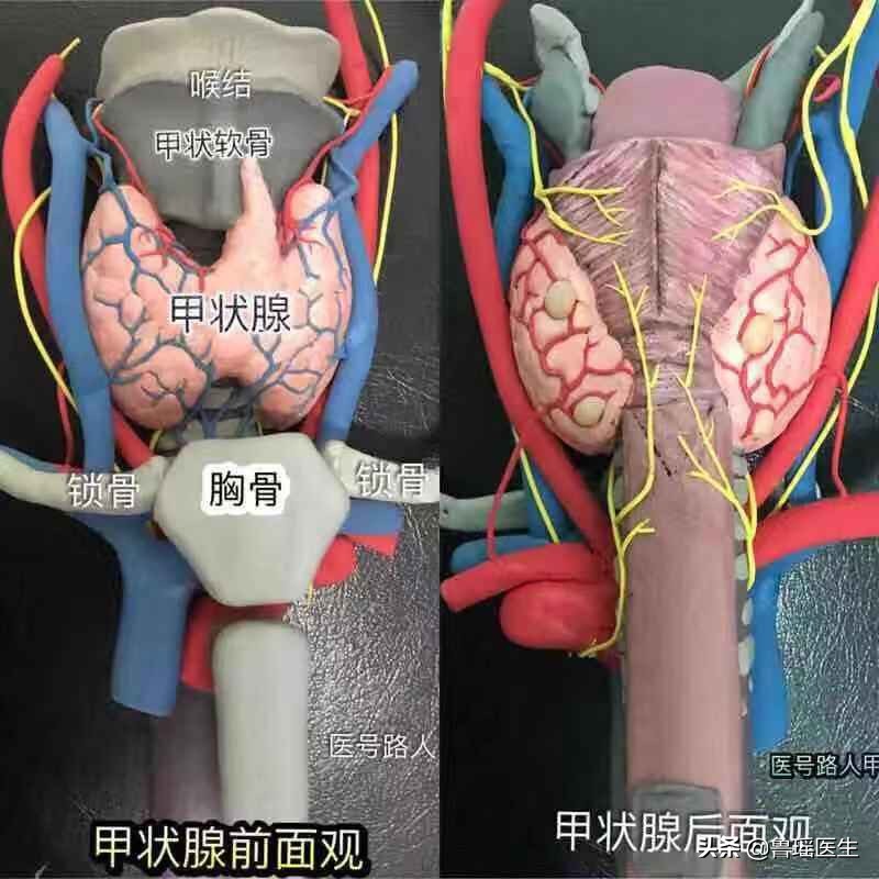 甲亢合并甲癌为什么要全切,甲亢合并甲状腺肿大怎么治疗