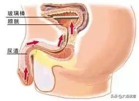 为什么女生尿尿需要纸巾擦,而男生不用?不能学男生抖抖吗?