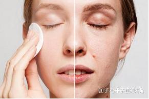20岁抗初老需要用到的产品及步骤,22岁就用抗初老合适吗