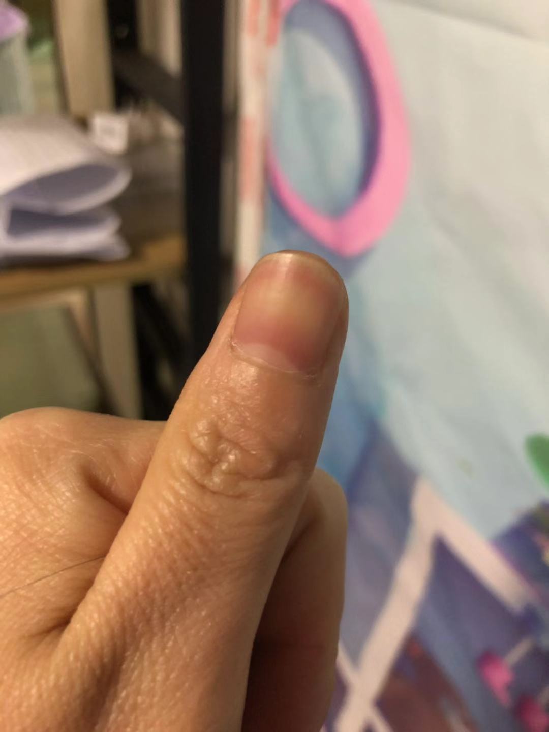 十个手指看健康图解,看手指知道身体情况