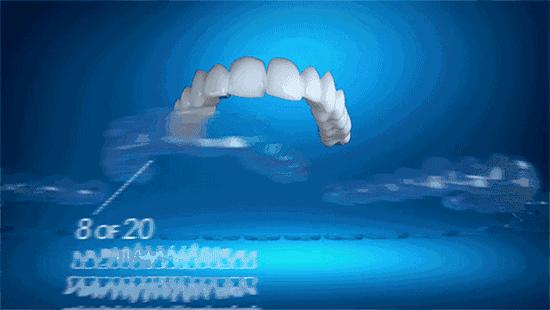 隐形矫正和传统的矫正有什么区别,舌侧矫正和隐形矫正哪个费用高