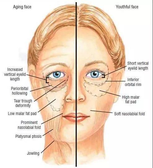 她靠“脸崩”博出位，曾经的女王要“凉凉”