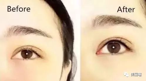 纹绣师操作美瞳线应该注意什么,为什么纹绣师不做美瞳线