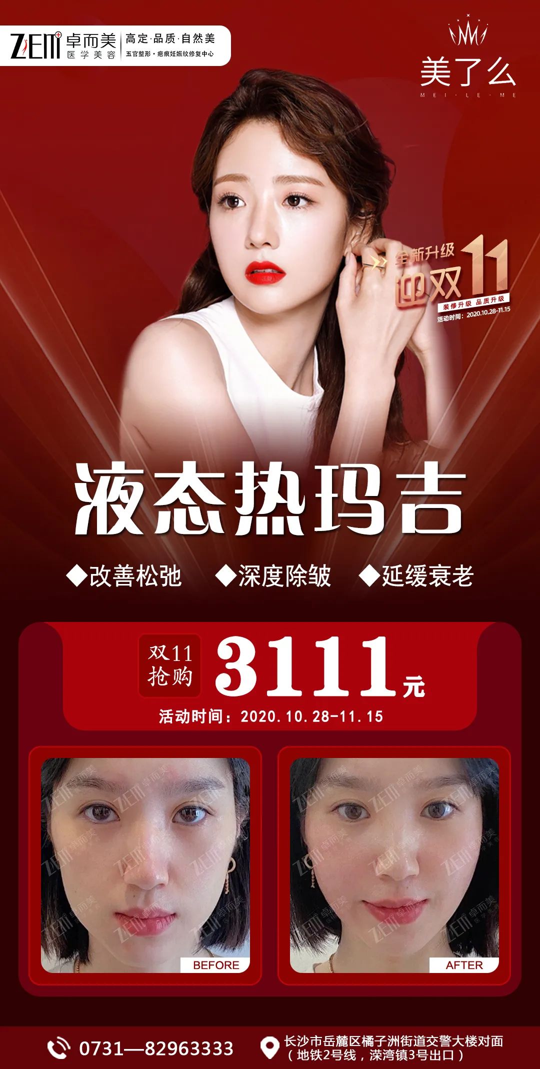 重磅！美了么“双十一”亿元补贴，携手百城专家团队来袭