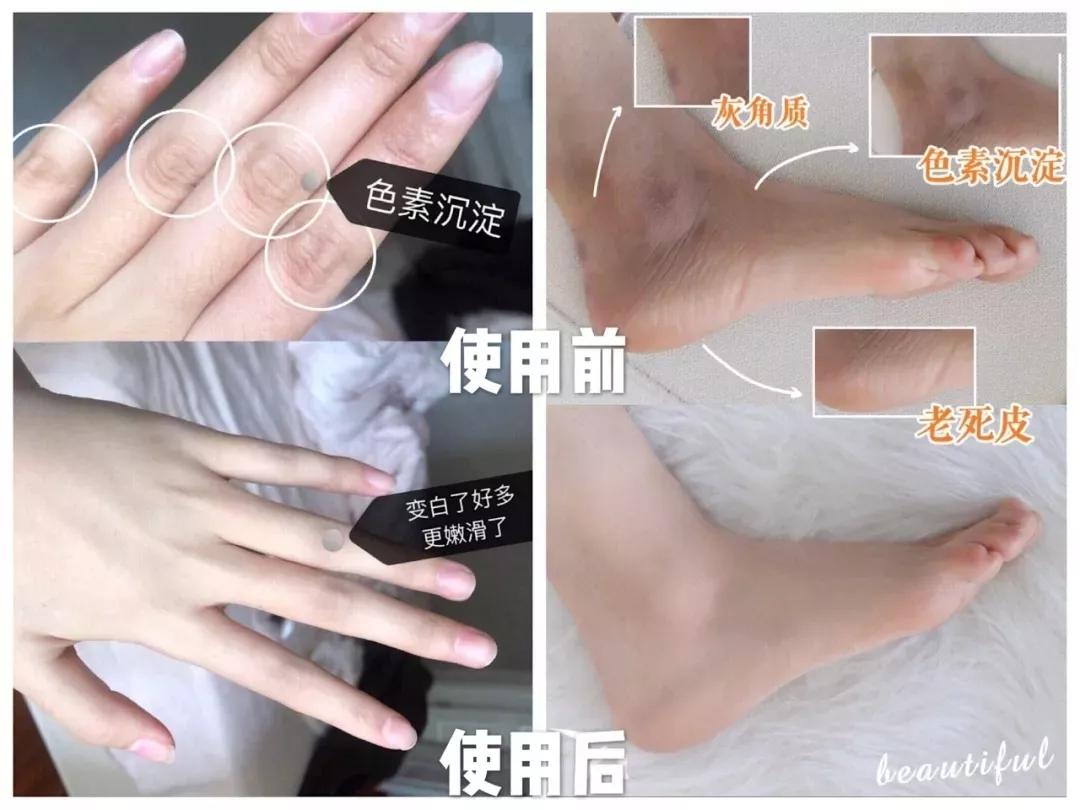 坚持涂身体乳还是很干,坚持涂身体乳二十年