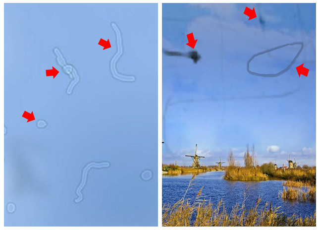 眼前恼人的“飞蚊”，还能不能治好了？