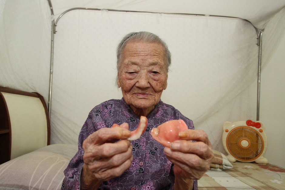 老假牙怎么修复,老年人假牙怎么保养